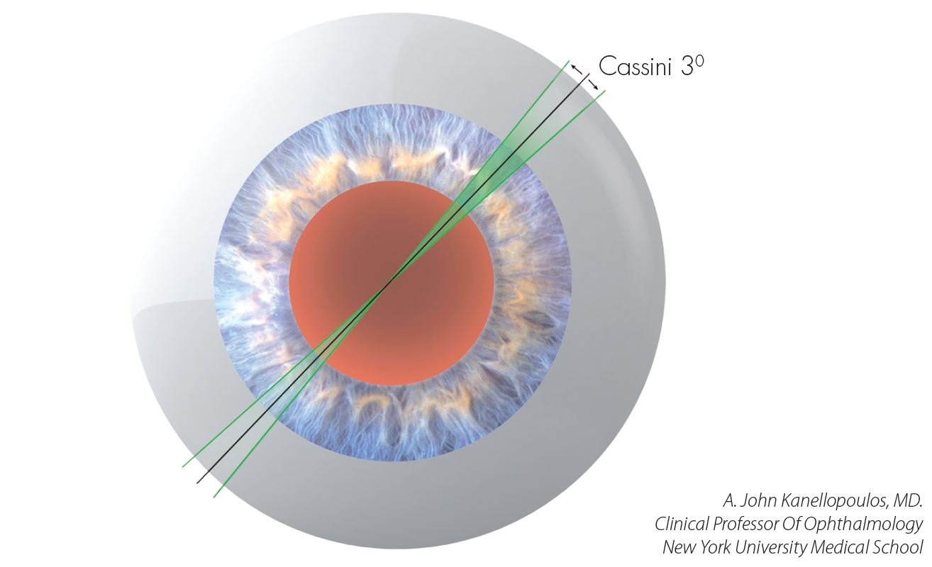 Cassini update Axis Eye 08132015